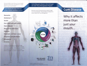 GumDisease 300x230