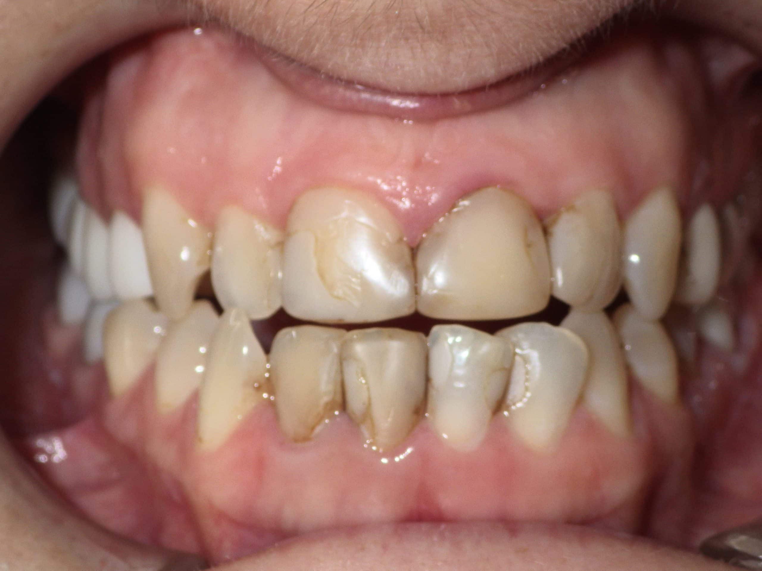 Gallery | Riverside, CA | Canyon Crest Dental