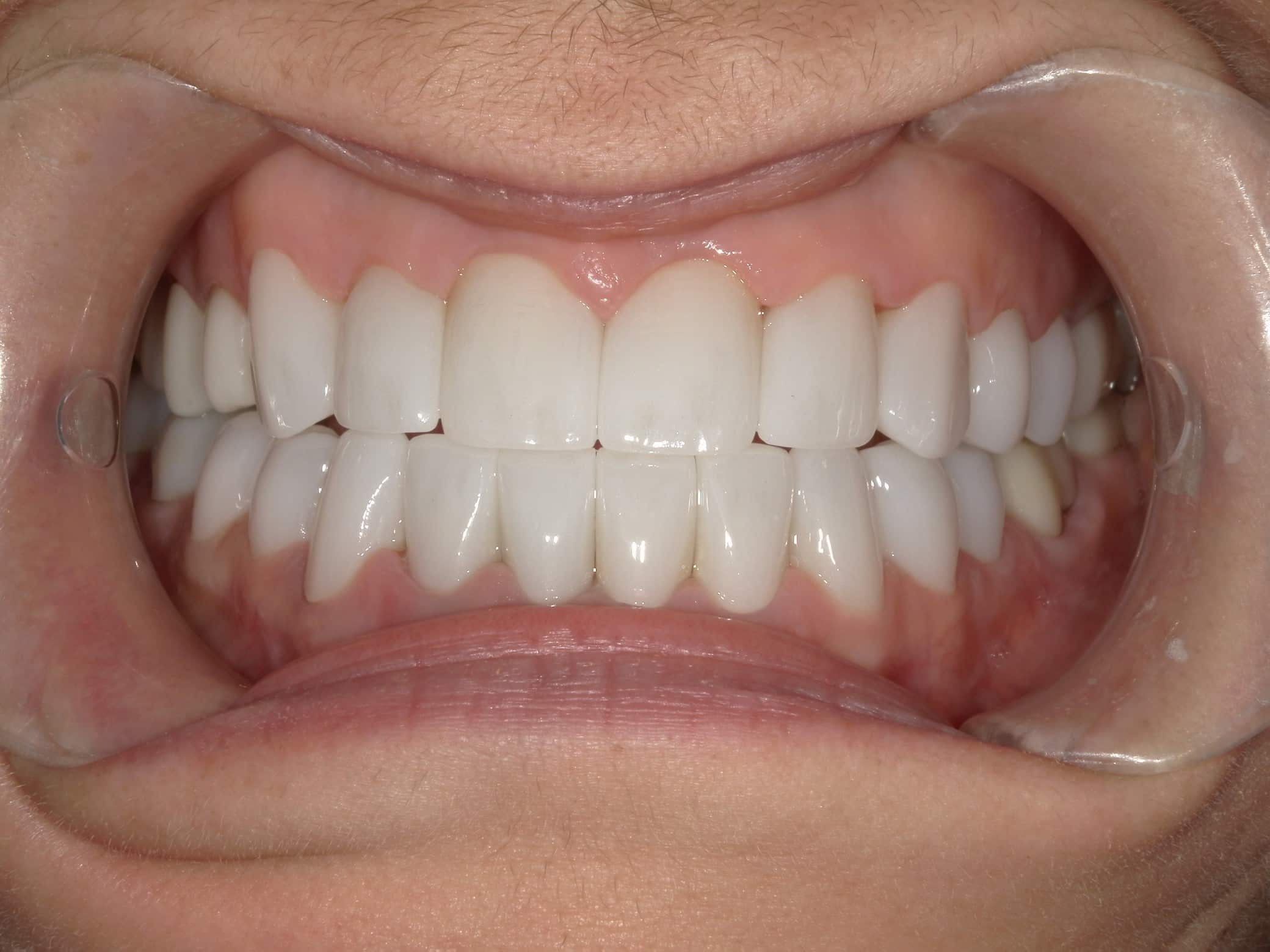Canyon Crest Dental