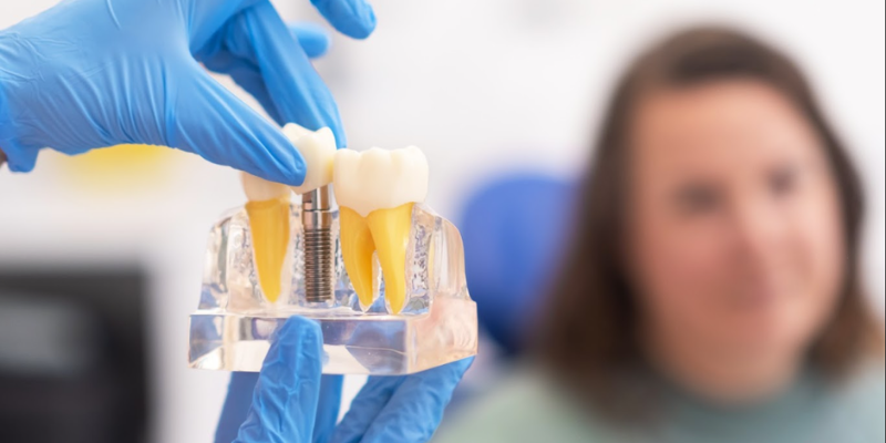 Dental Implants in Riverside CA